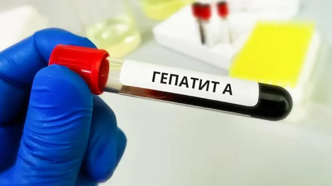 Аналіз крові на виявлення гепатиту А. Фото: КиївВлада